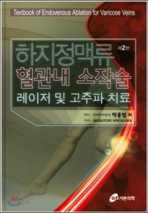 하지정맥류 혈관내 소작술